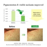 Dr. Althea Gentle Vitamin C Serum (30ml)