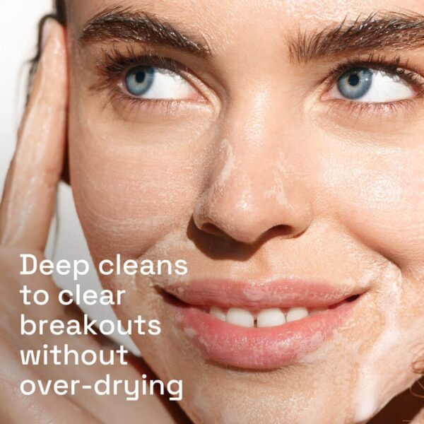Cetaphil Gentle Clear Clarifying Acne Cream Cleanser (124 ml)