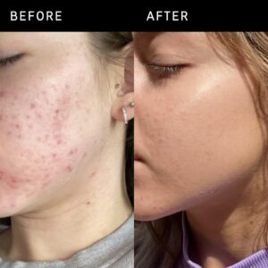 the-inkey-list-niacinamide-serum-30ml-ink-srm-0004-empress-origin-01