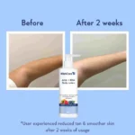 WishCare AHA + BHA Body Lotion (200 ml)