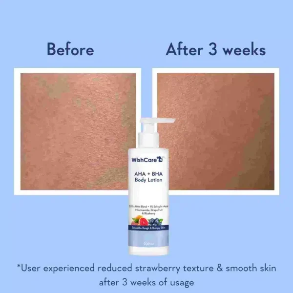 WishCare AHA + BHA Body Lotion (200 ml)