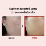 Medipeel — Melanon X Cream 30ml
